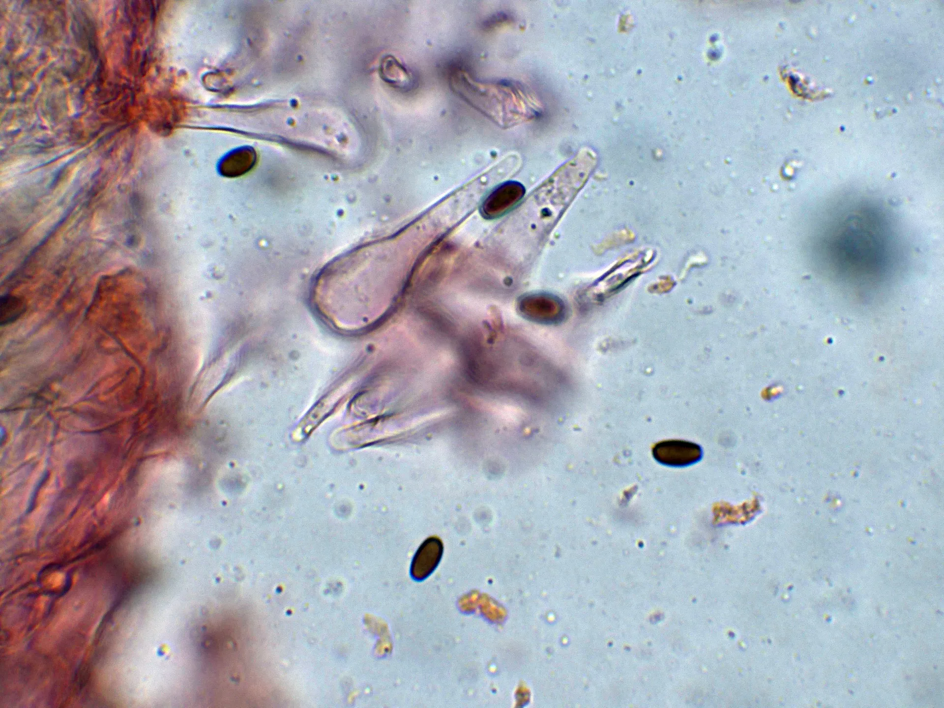 Microscopía de Psathyrella berolinensis - 10 - Caulocistidios-003